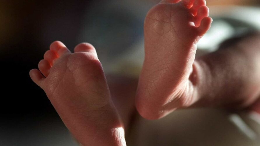  Bebê nasce com três pênis e é o primeiro caso no mundo