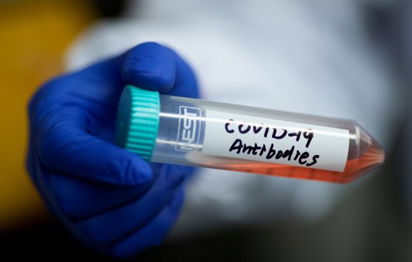  Cerca de 1,3 milhão de pessoas possuem anticorpos da Covid-19 no Estado do Pará