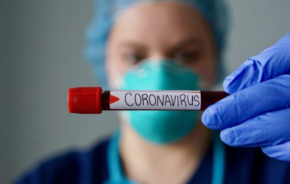  Governo do Estado do Pará Domingo, 1 de março de 2020 Exame para coronavírus em paciente de Belém dá negativo, confirma Sespa