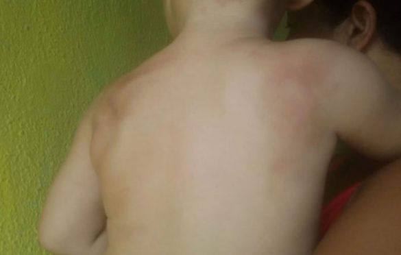  Criança de 2 anos é agredida em creche de Belém, denuncia família