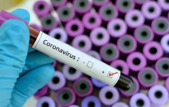  Segundo caso de coronavírus no Brasil é confirmado pelo Ministério da Saúde